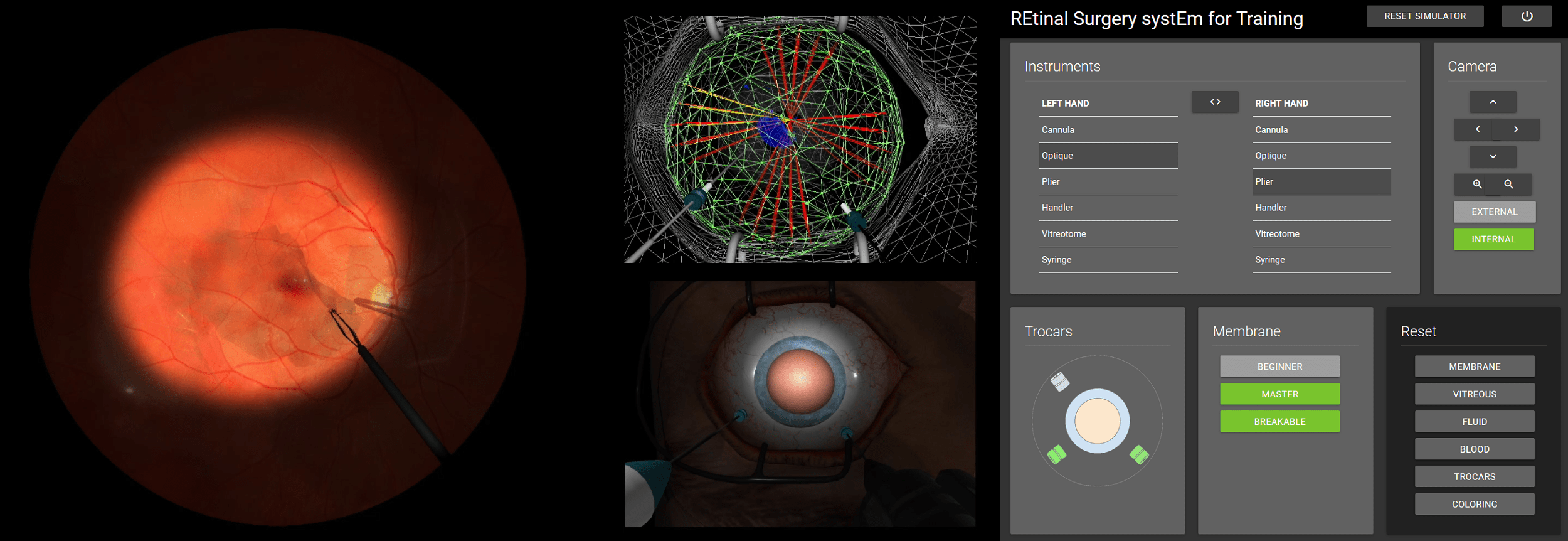 ANR funded RESET project (REtinal Surgery systEm for Training)