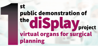 1st public demonstration of diSplay Project, Virtual Organs for Surgical Planning