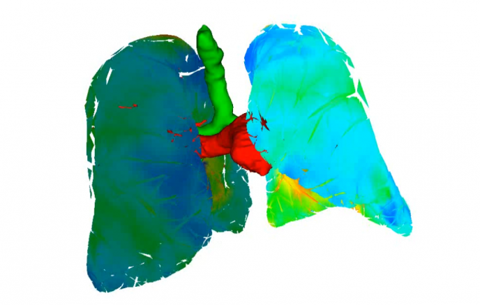 Virtual model of patient-specific lungs and visualisation of tensions on the organ's tissues