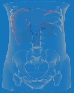 diSplay - urology surgery planning