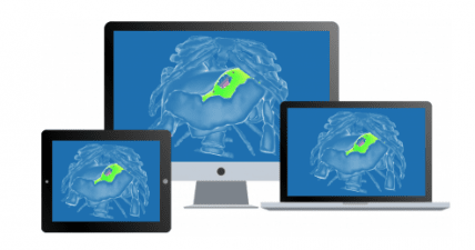 Station tactile diSplay + accès à un module chirurgical au choix