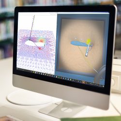 InSimo - Custom Robotic Suturing