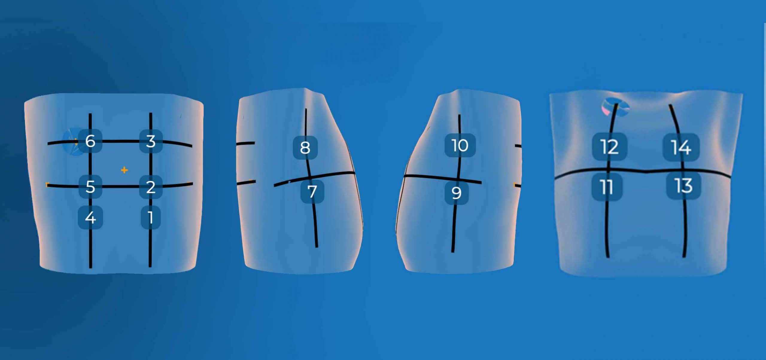 pocus ultrasound protocol