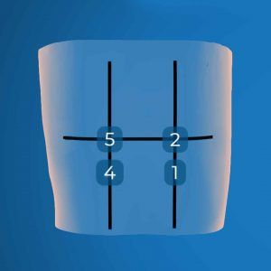 pocus ultrasound protocol