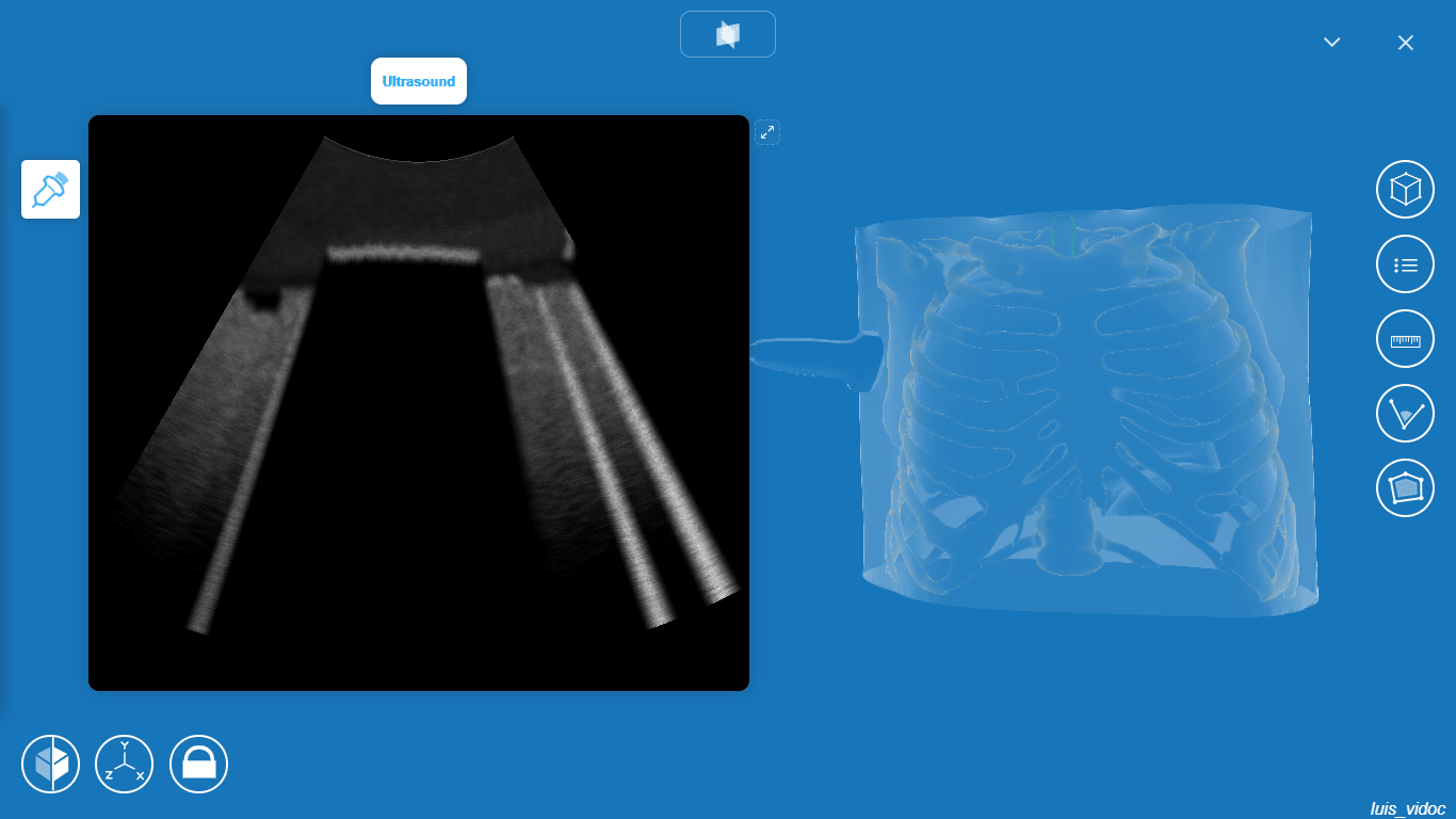 ultrasound simulation