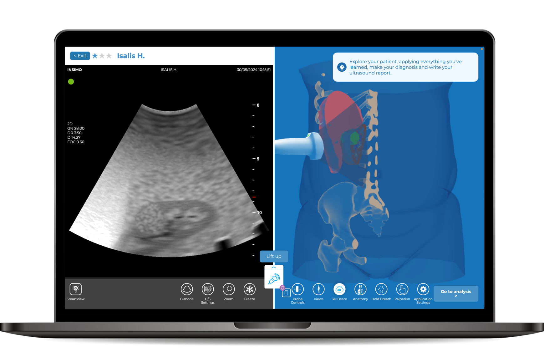 Renal Clinical ultrasound