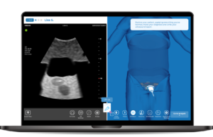Bladder and Prostate Ultrasound