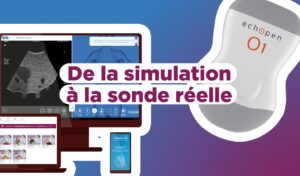 InSimo & echOpen_De la simulation à la sonde réelle